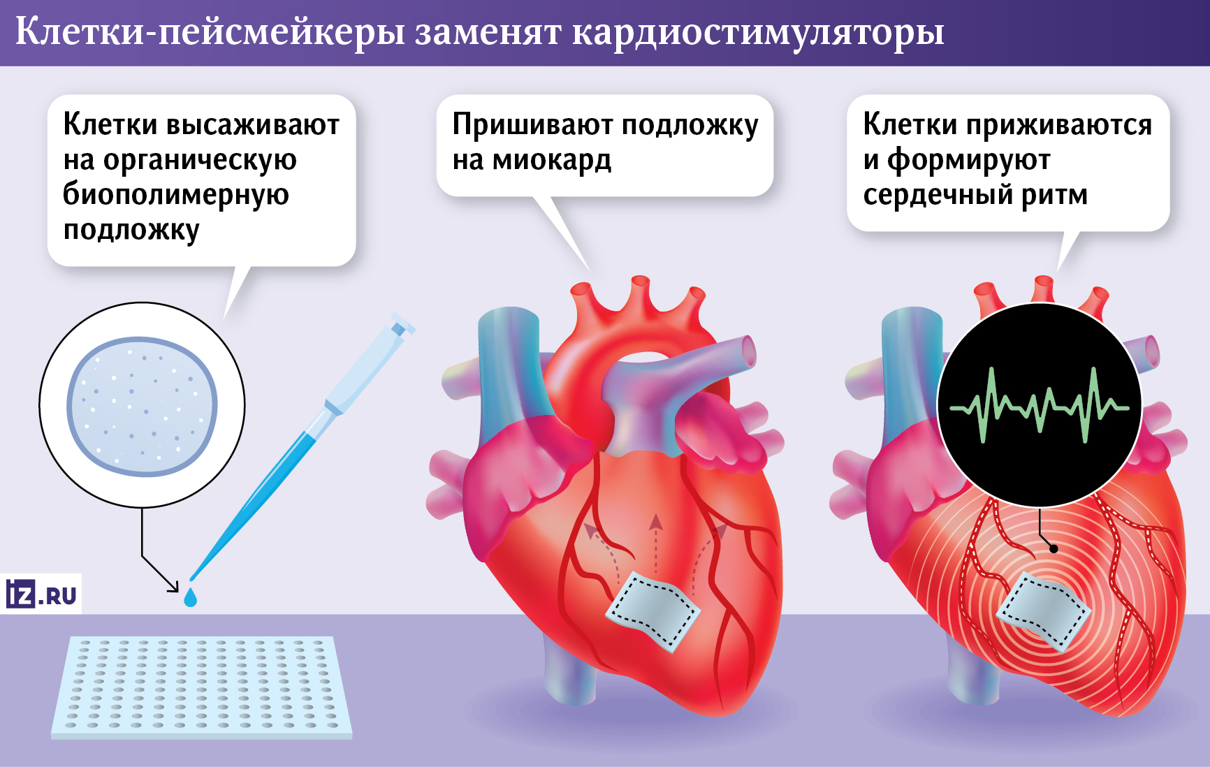 Инфографика