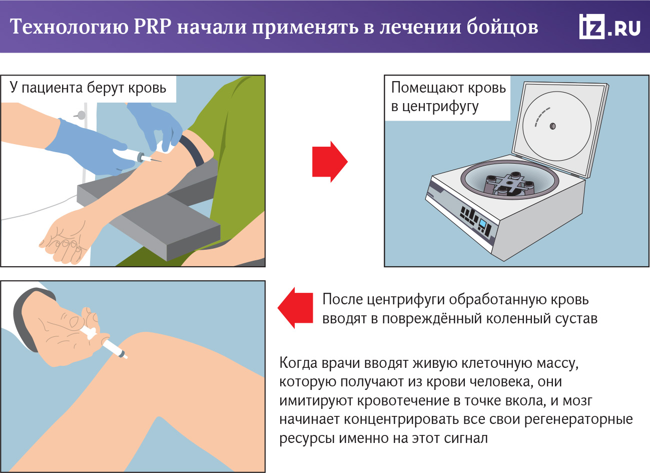 Инфографика