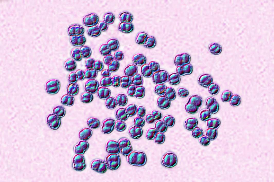 Возбудитель менингококковой инфекции под микроскопом